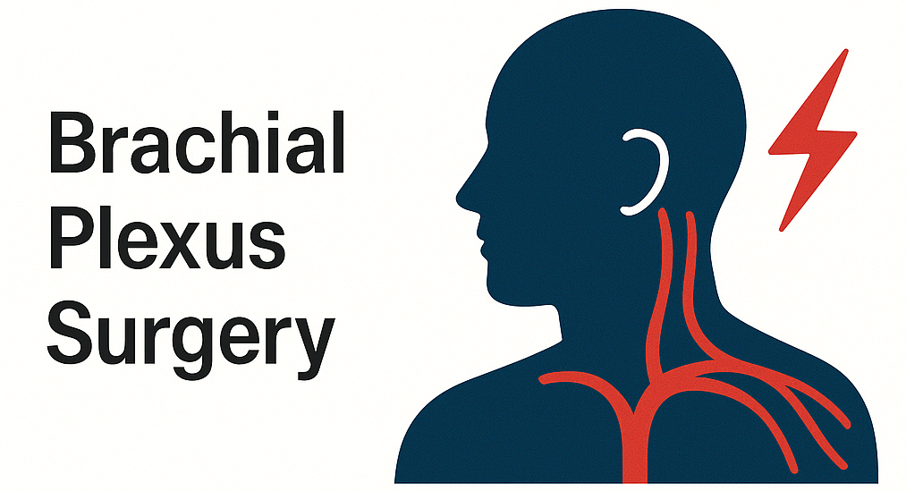 Brachial Plexus Surgery